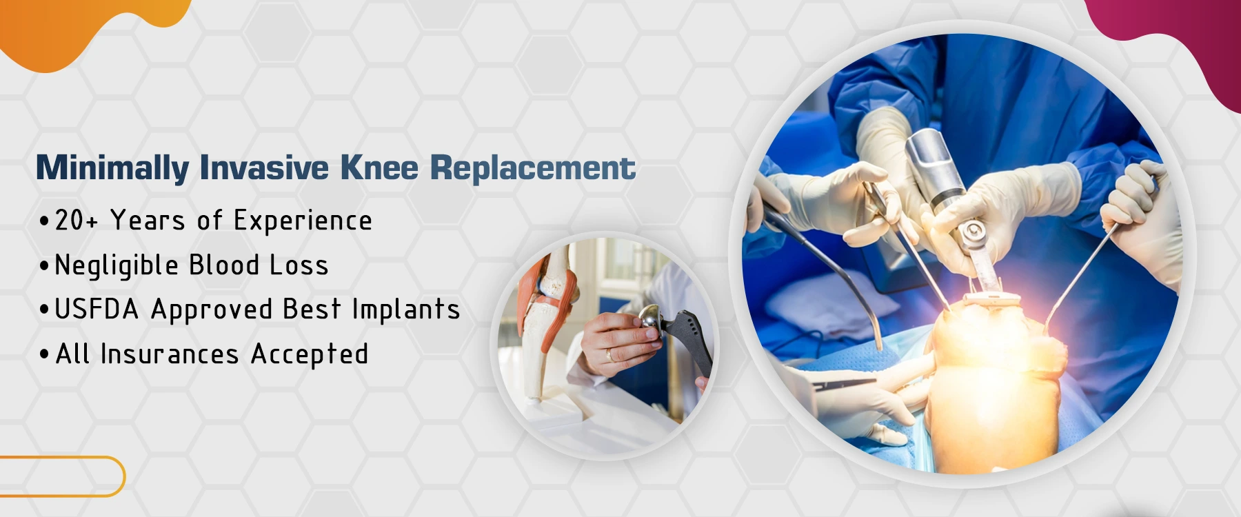 best hip replacement surgeon in rohini