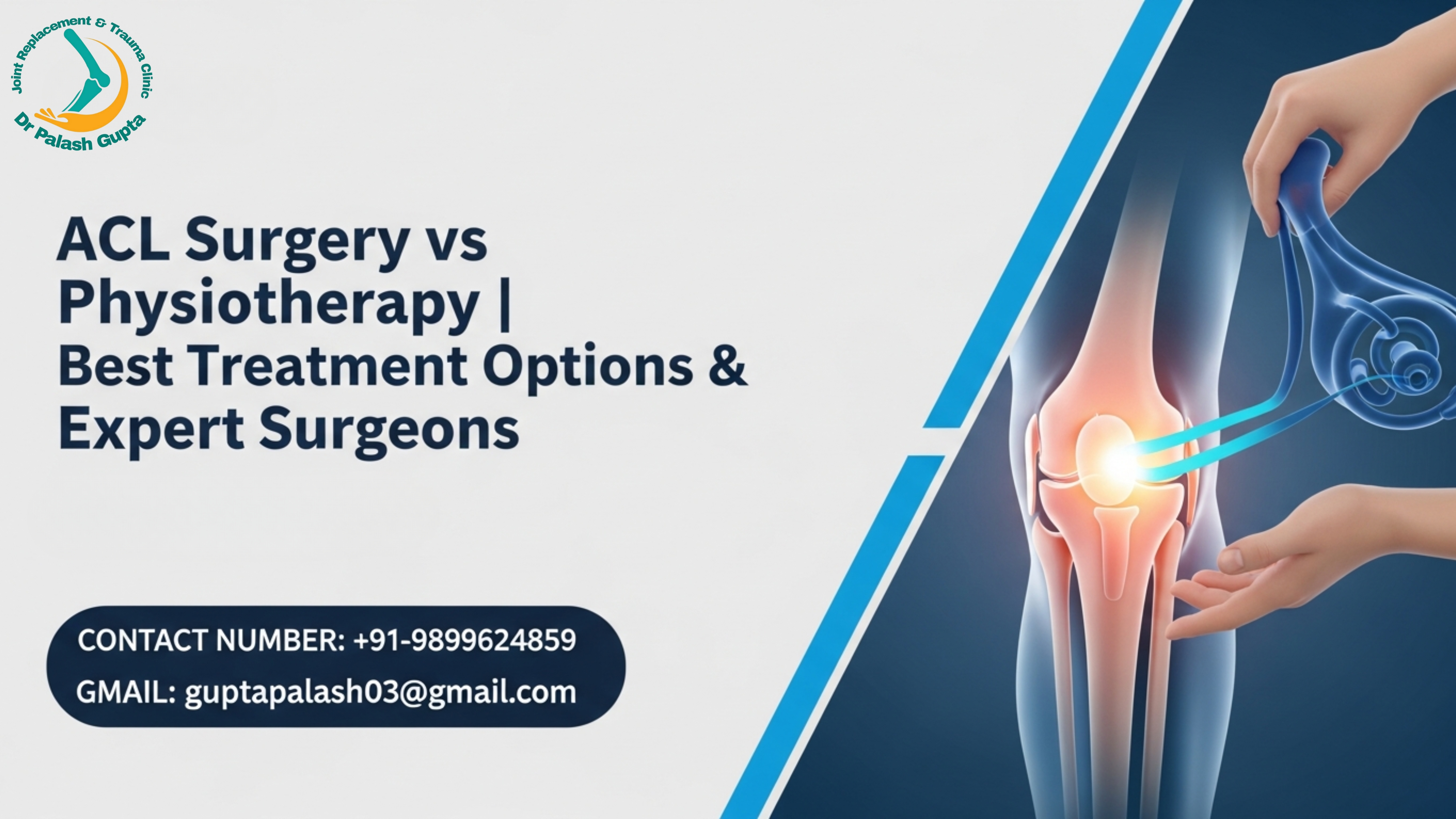 ACL surgery vs physiotherapy




