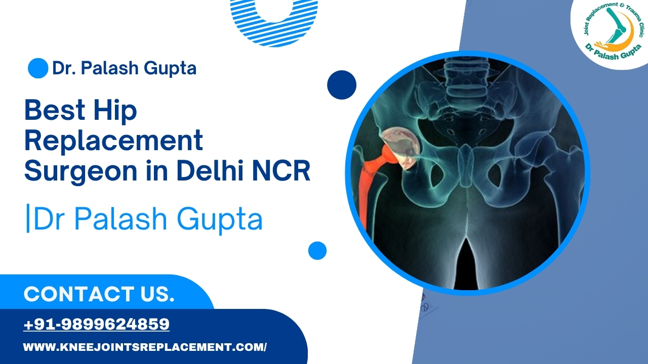 best hip replacement surgeon in Delhi NCR




