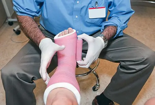 Rehabilitation and Recovery